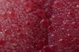 Raspberry taste buds